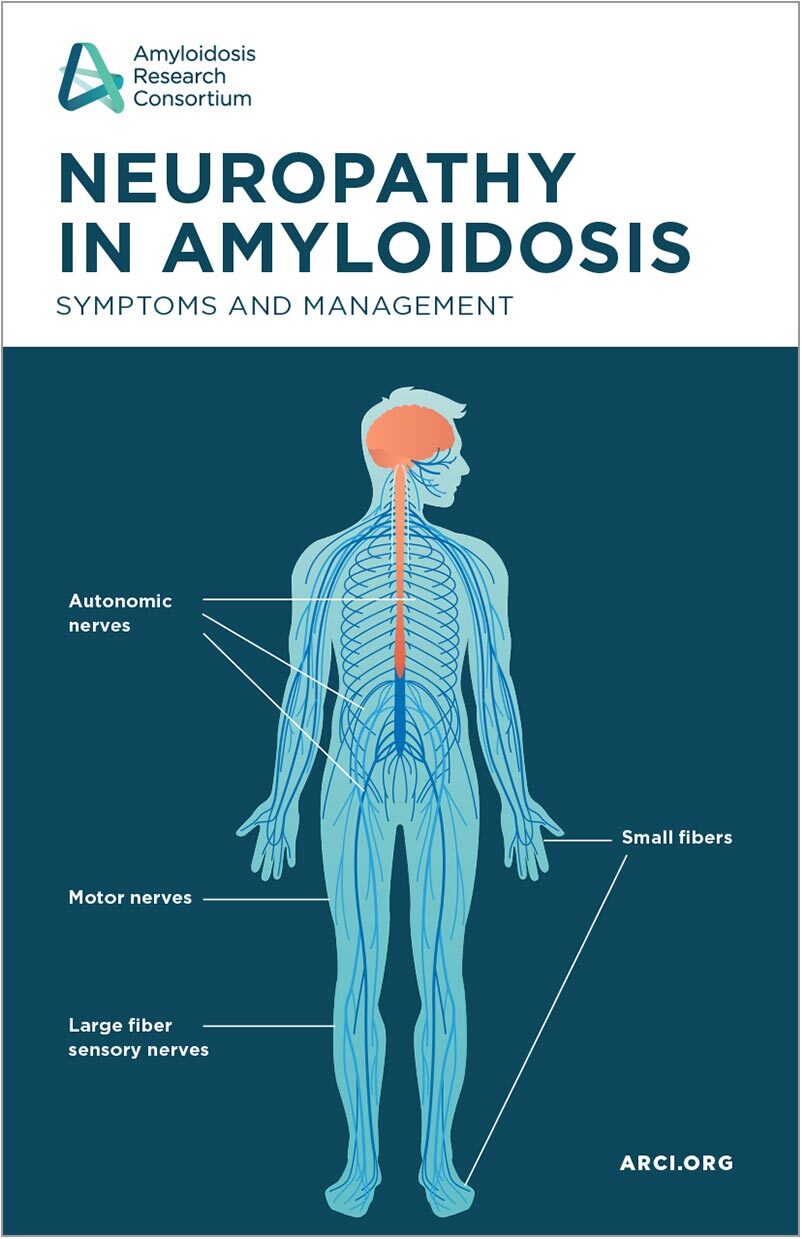 Neuropathy in Amyloidosis